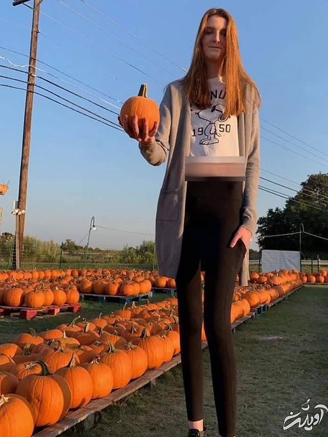 گرفتاری‌های دختری که صاحب بلندترین ساق‌های جهان است/ تصاویر